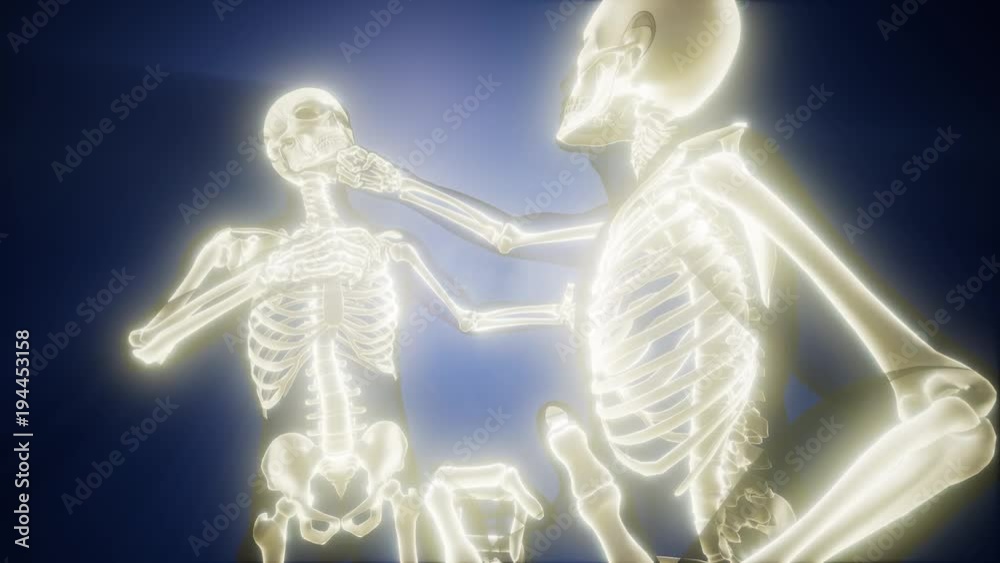 fighting men with visible bones fighting men with visible bones