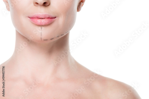 Cropped view of woman with painted lines on face for plastic surgery isolated on white
