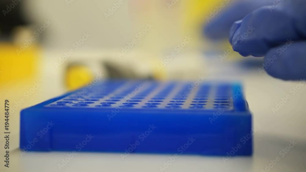 Laboratory test plate. researcher pipetts samples in well microplate. medical test of blood or dna. test of cancer or virus. Scientist researching in laboratory. peronalized medicine and diagnostic