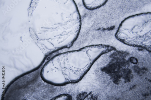 Mold at the microscope
