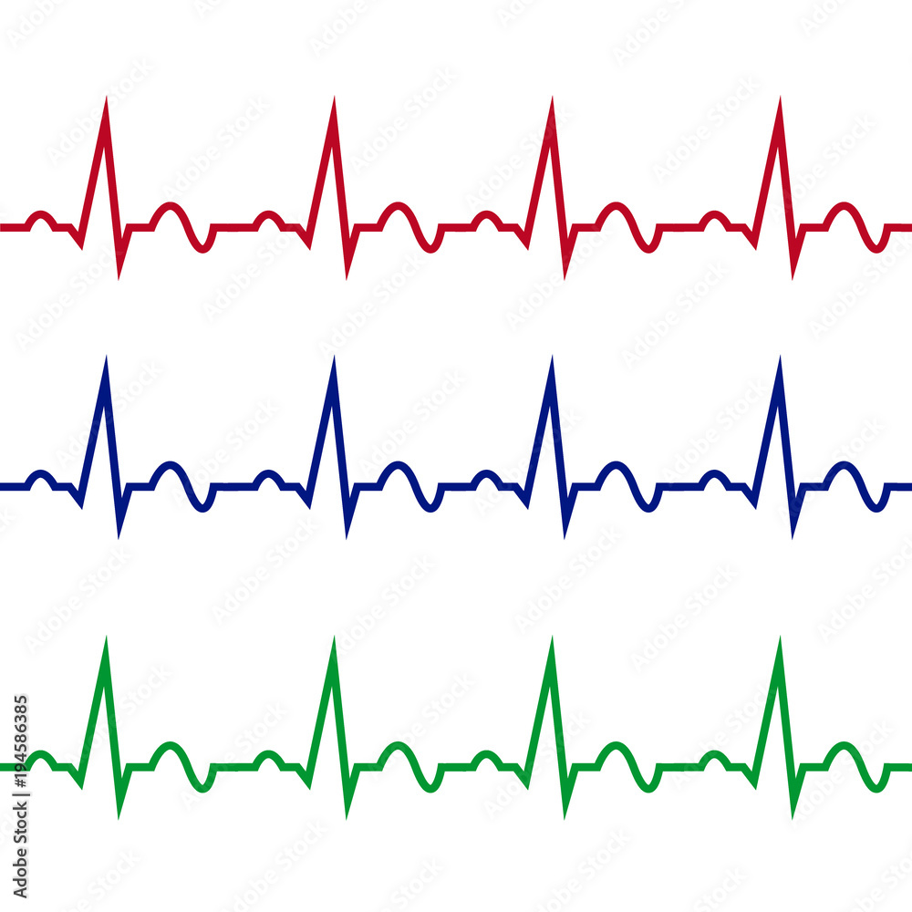 Electrocardiogramas