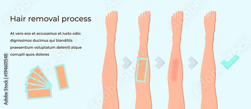 Wax hair removal