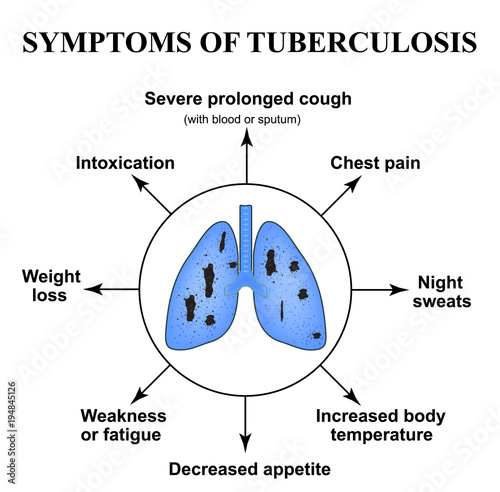 Symptoms of tuberculosis. World Tuberculosis Day. March 24. The structure of the lungs. Infographics. Vector illustration on isolated background.