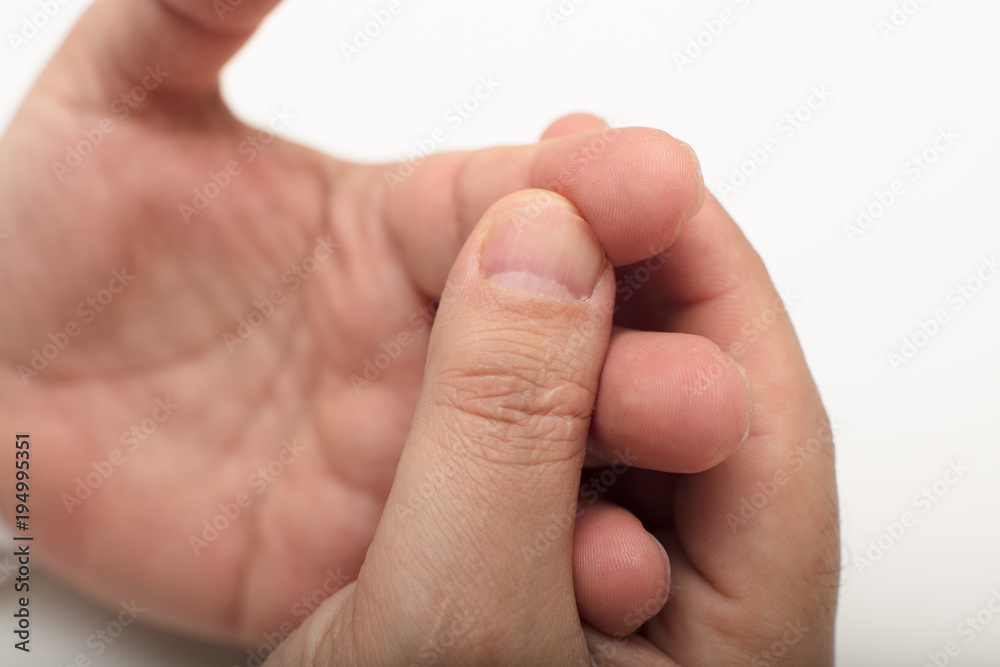 Man squeezing his finger after pricking it Man squeezing his finger after pricking it