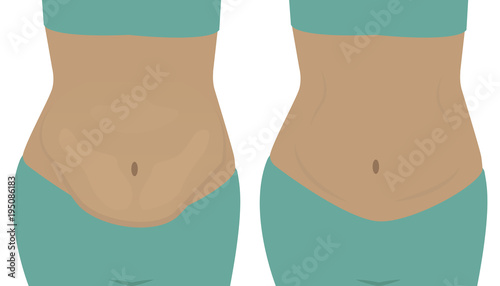 Fat and slim  girls' bellies. Before and after.  