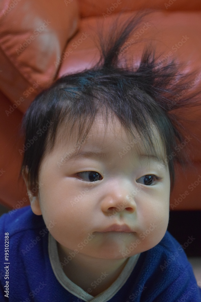 Baby with a habit of head hair while sleeping, 9 months of age Baby with a habit of head hair while sleeping, 9 months of age