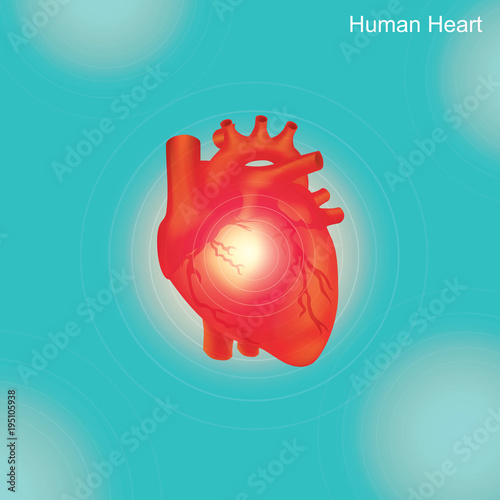Human Heart. Angioplasty is an endovascular procedure to widen narrowed or obstructed arteries or veins, typically to treat arterial atherosclerosis