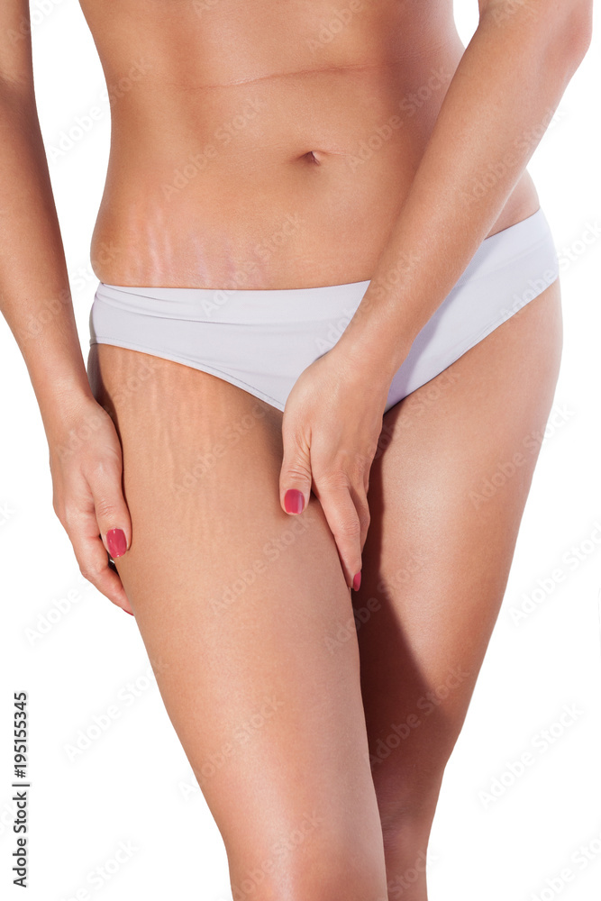 Woman cellulite and fat on thigh