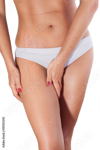 Woman cellulite and fat on thigh