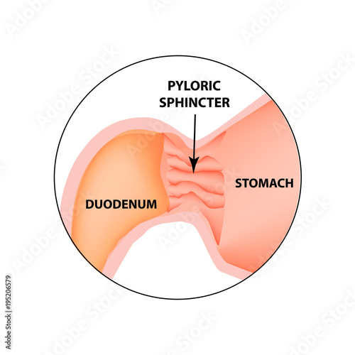 Pyloric sphincter of the stomach duodenum. Pylorus. Infographics. Vector image on isolated background