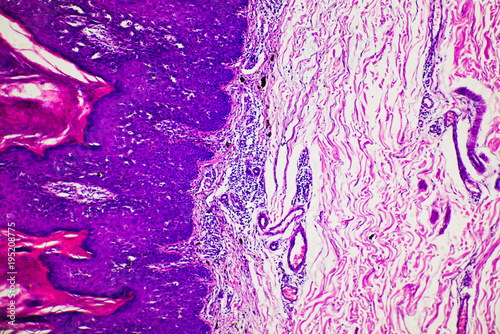ill human skin