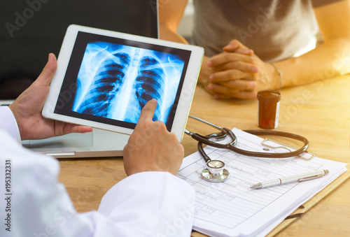 Doctor shows results to old patient x-ray of the lungs, smoking cigarettes problem