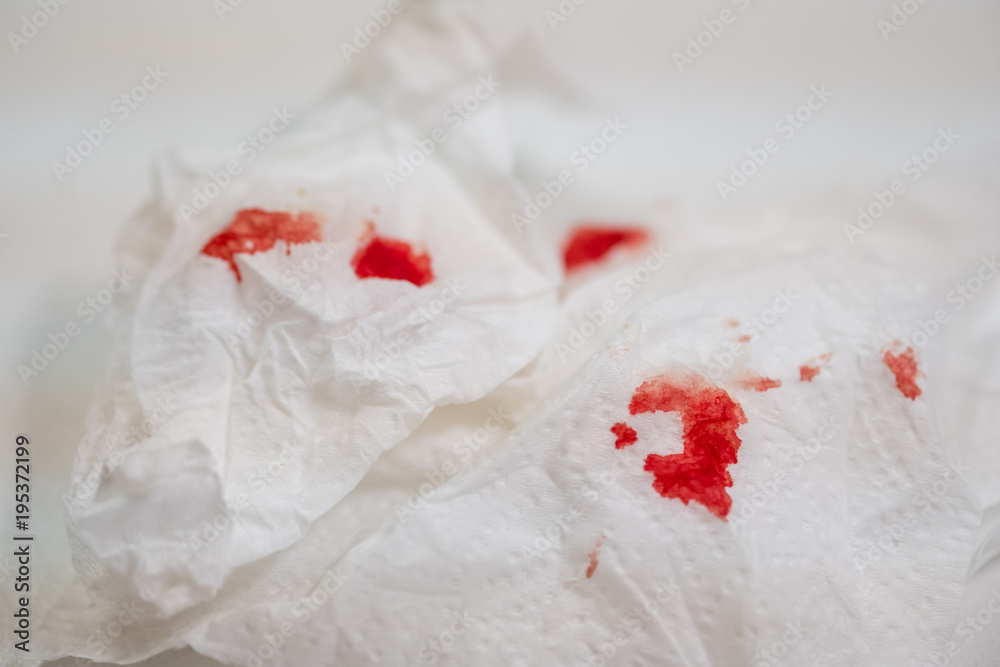 Red blood on tissue toilet paper. Stock Photo | Adobe Stock