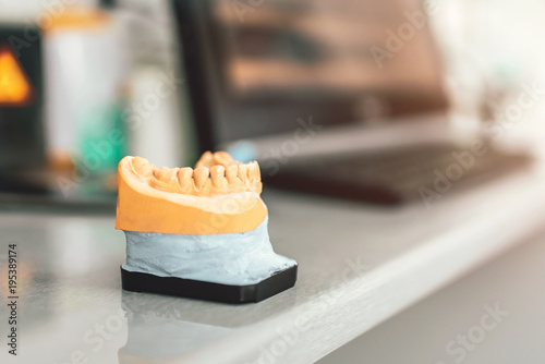 Canvas-taulu Dental gypsum model of the teeth in the cliinic