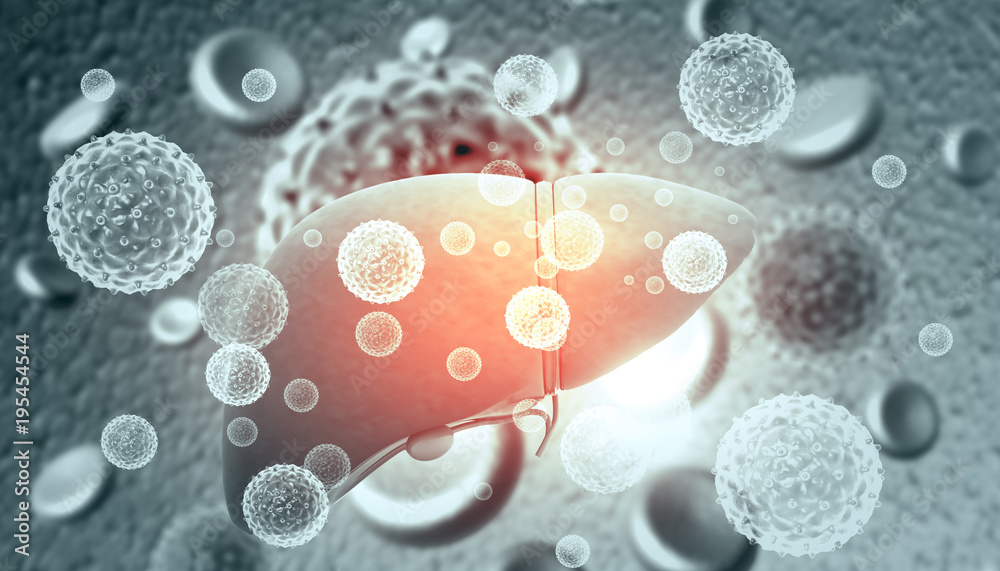 Αυτοκόλλητο Liver Infection with hepatitis viruses. 3d illustration .