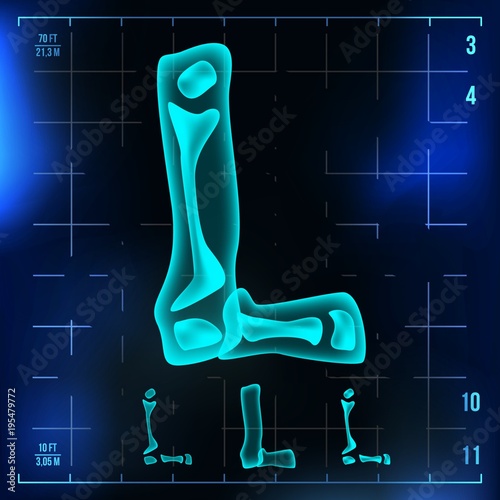 L Letter Vector. Capital Digit. Roentgen X-ray Font Light Sign. Medical Radiology Neon Scan Effect. Alphabet. 3D Blue Light Digit With Bone. Medical, Hospital, Futuristic, Horror Style. Illustration