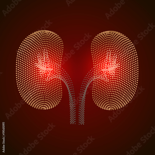  kidney disease silhouette icon. Stones in the kidneys. Pyelonephritis. Urolithiasis disease