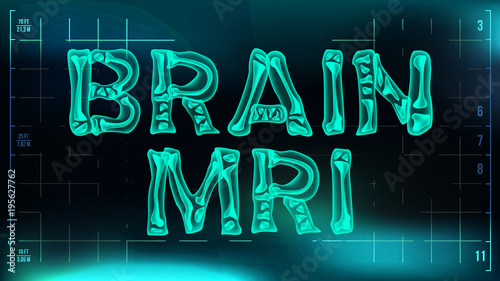 Brain mri Banner Vector. Medical Background. Transparent Roentgen X-Ray Text With Bones. Radiology 3D Scan. Medical Health Typography. Futuristic Technology Illustration