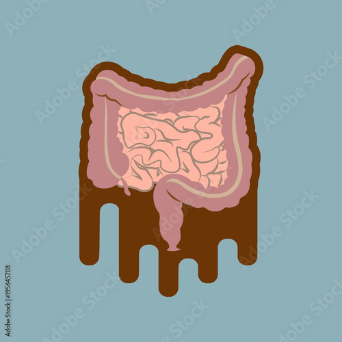 Human digestive system intestines gut anatomy gastrointestinal tract diagram. Meteorism, Enteritis, Colitis, Ulcerative Colitis, Dysbacteriosis, Diarrhea. Diseases of the intestine