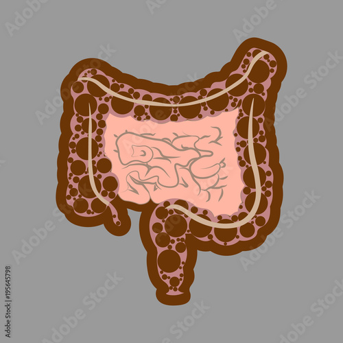 Human digestive system intestines gut anatomy gastrointestinal tract diagram. Meteorism, Enteritis, Colitis, Ulcerative Colitis, Dysbacteriosis, Diarrhea. Diseases of the intestine