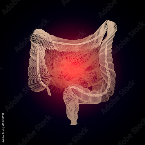 3D human organ Medicine concept with line. Human digestive system intestines gut anatomy gastrointestinal tract diagram. Meteorism, Enteritis, Colitis, Ulcerative Colitis, Dysbacteriosis, Diarrhea.