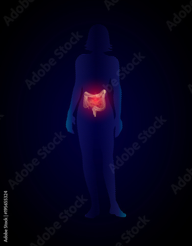  silhouette of woman with intestines, medical illustration. Meteorism, Enteritis, Colitis, Nonspecific ulcerative colitis, Dysbacteriosis, Diarrhea. Diseases of the intestines