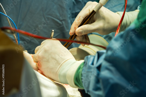 Photography Operation of trepanation of the skull.