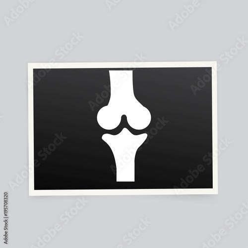 X-ray of the knee. Vector illustration.