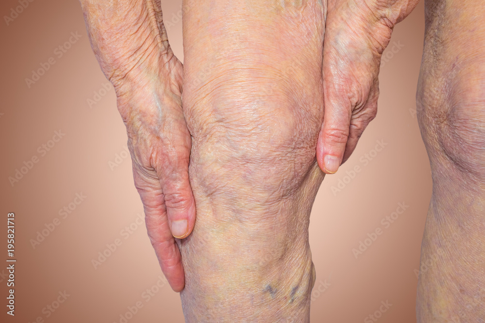 Fototapeta premium Senior woman holding the knee with pain
