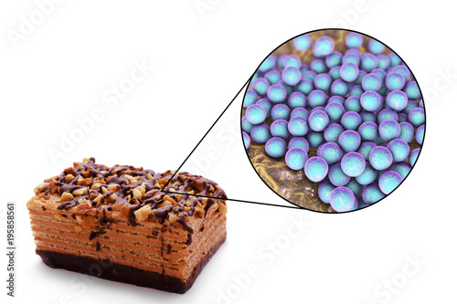 Staphylococcal food poisoning, medical concept, 3D illustration showing cake as a common source of food infection and close-up view of S. aureus bacteria contaminating food photo