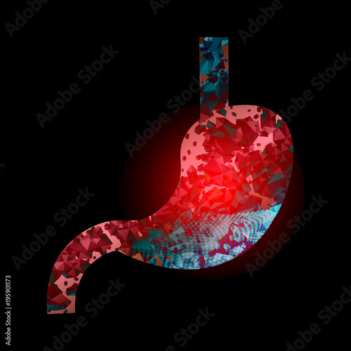 Heaviness in the stomach. Colitis. Medical illustration of stomach diseases