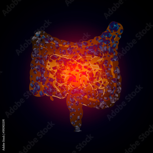 Heaviness in the intestines. Colitis. Medical illustration of intestinal diseases