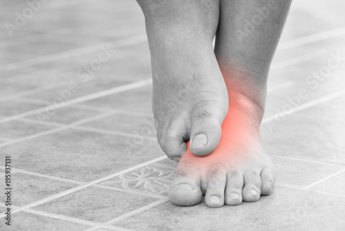 Close up man scratch the itchy feet by other foot at home. Healthcare and medical concept. photo