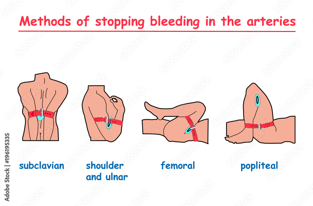Bleed формы