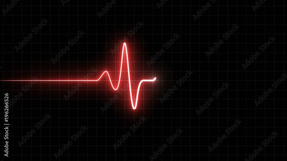 EKG 60 BPM Loop Screen, Red w/ Grid. Heart rate monitor / electrocardiogram (EKG or ECG) loop beeping at 60 beats per minute for screen savers or computer monitor displays, animated at 60fps.
