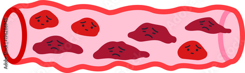 Unhealthy blood vessel face 1