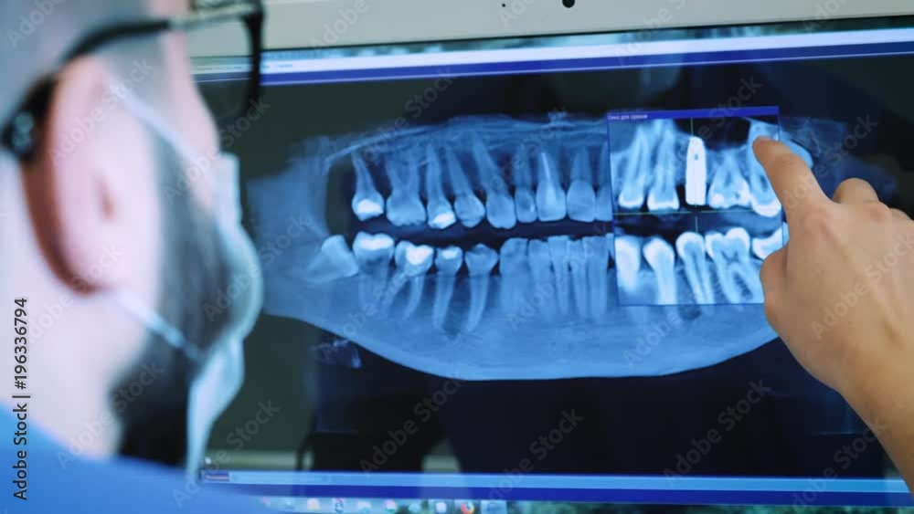 the dentist is studying the x-ray 3D image of the jaw.