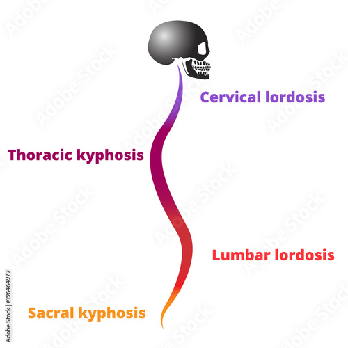 Diseases of the spine. Lordosis, kyphosis. Body posture defect. Realistic skull with a silhouette of the spine isolated on white. Vector illustration.