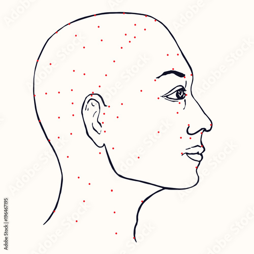 Face (profile) acupuncture scheme with red points, hand drawn doodle, sketch in pop art style, black and white medical vector illustration