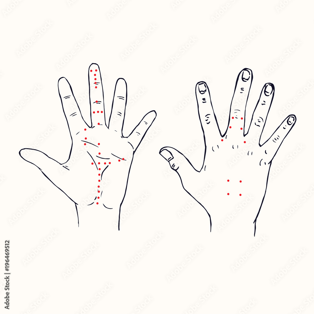 Hands (palm of left hand and dorsum of right hand) Korean acupuncture scheme with red points, hand drawn doodle, sketch in pop art style, black and white medical vector illustration - obrazy, fototapety, plakaty 