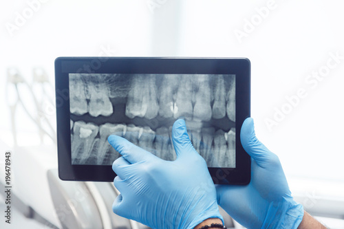 Intelligent dentist showing teeth x-ray on tablet, well-built man in green mask and blue gloves explaining particular case, sitting before dental chair in light huge office