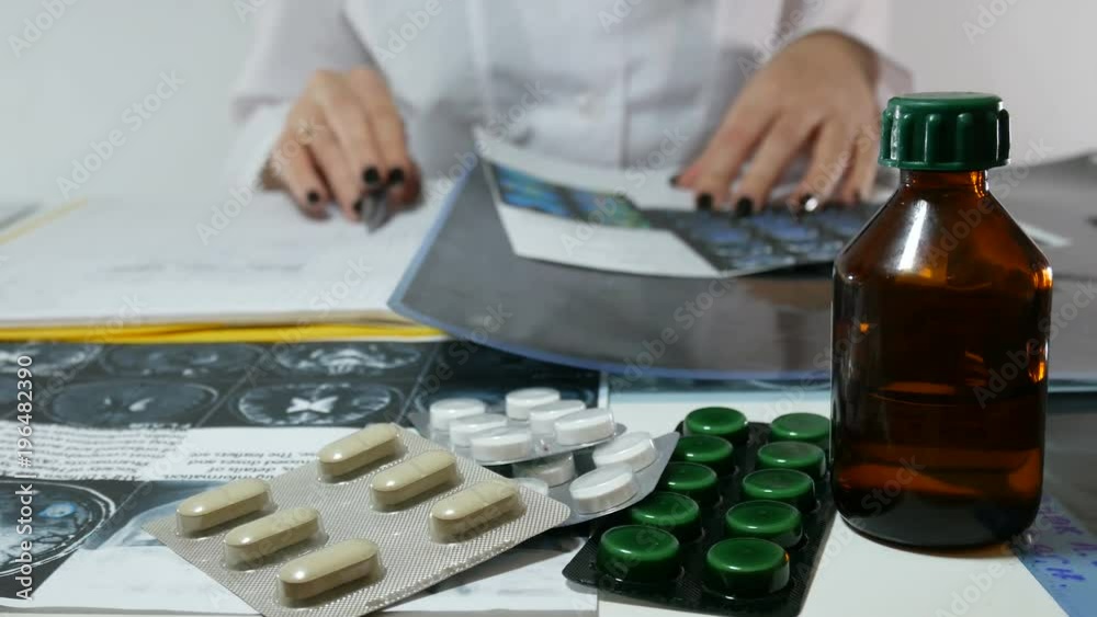The doctor works in a modern private hospital. He looks at the x-ray of the patient in the medical office.