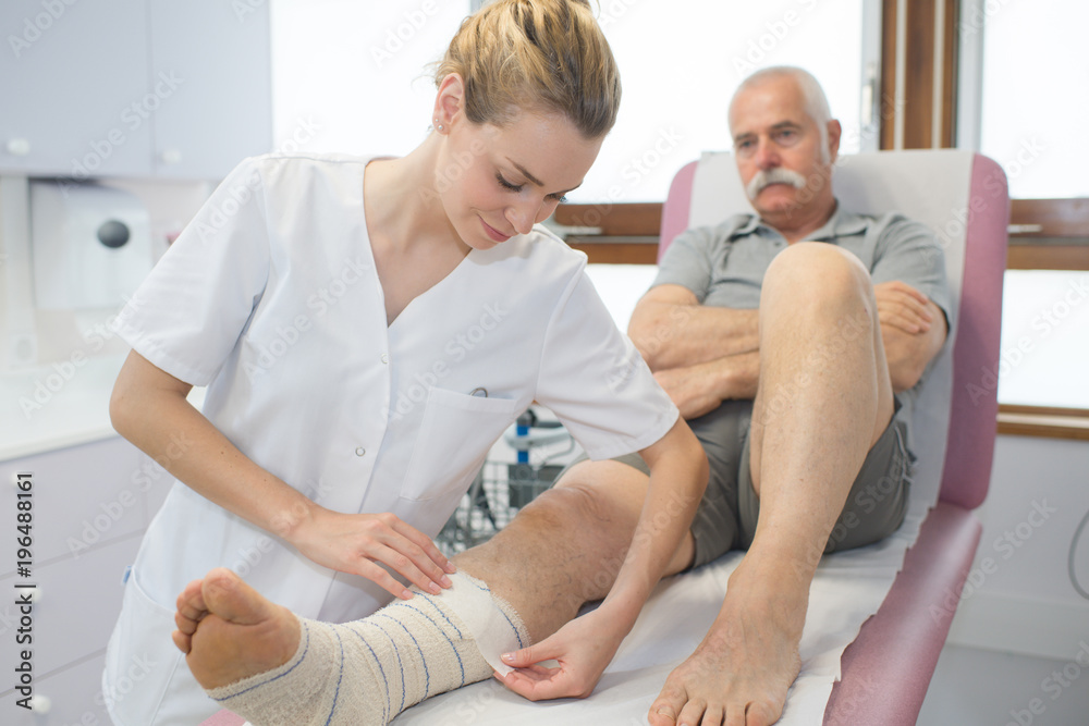 Obraz premium nurse splint cast on the leg patient in hospital
