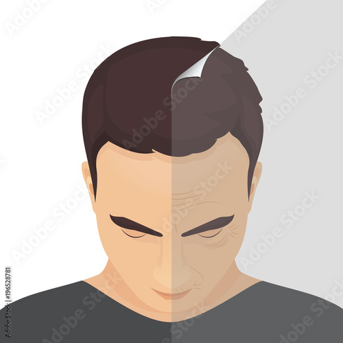 Close up vector portrait of a man before and after cosmetic procedure. Beauty facial injections for men. Anti-ageing therapy for facelift and wrinkles. Male rejuvenation treatment infographics.