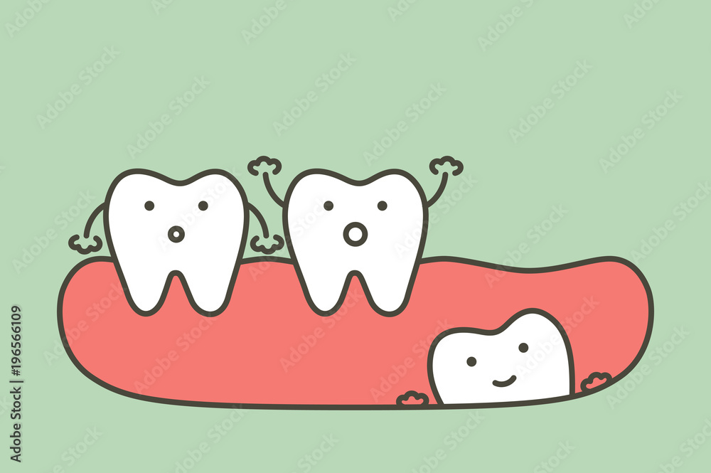 wisdom tooth ( angular or mesial impaction ) affect to other teeth wisdom tooth ( angular or mesial impaction ) affect to other teeth