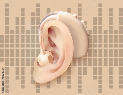 Digital hearing aid behind the ear, on the background of sound wave diagram. Treatment and prosthetics of hearing loss in otolaryngology. Realistic vector illustration. Medicine and health.