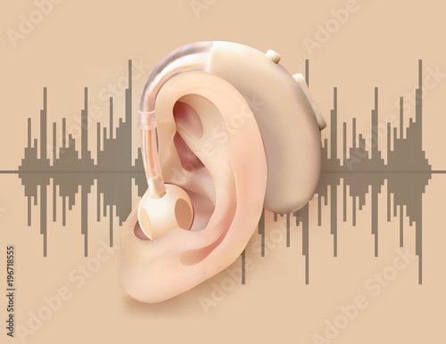 Digital hearing aid behind the ear. Ear and sound amplifier on background of  sound wave . Treatment and prosthetics of hearing loss in otolaryngology. Realistic vector illustration of medicine