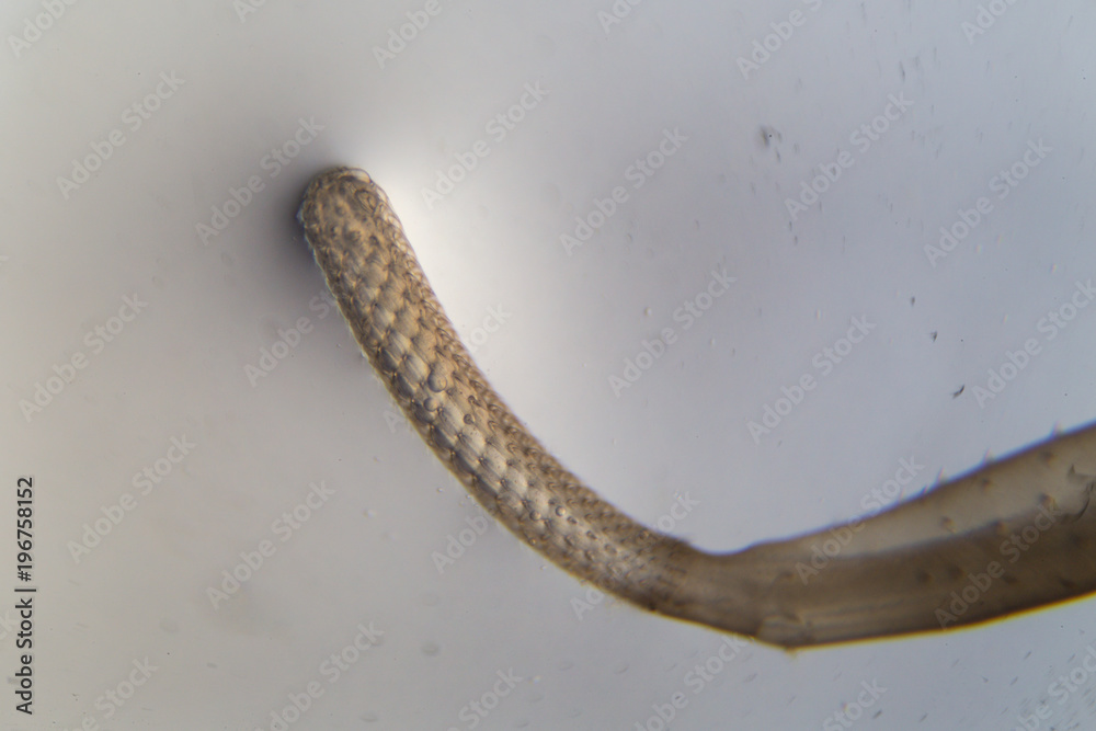 glance Pronoun Semicircle Parasitic (Thorny-head worm) under the microscope of education in  laboratory. Stock Photo | Adobe Stock