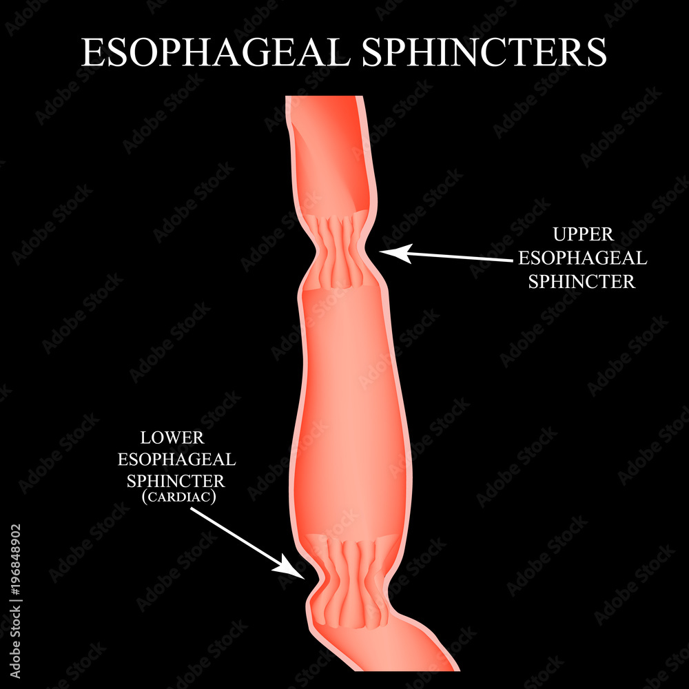 Upper sphincter of esophagus. Lower cardiac esophageal sphincter
