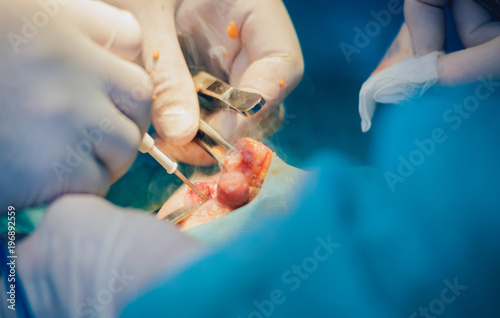 Breast surgery in the operating room.